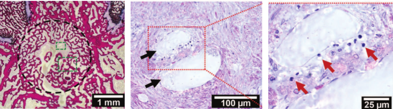 fig3_bone_2