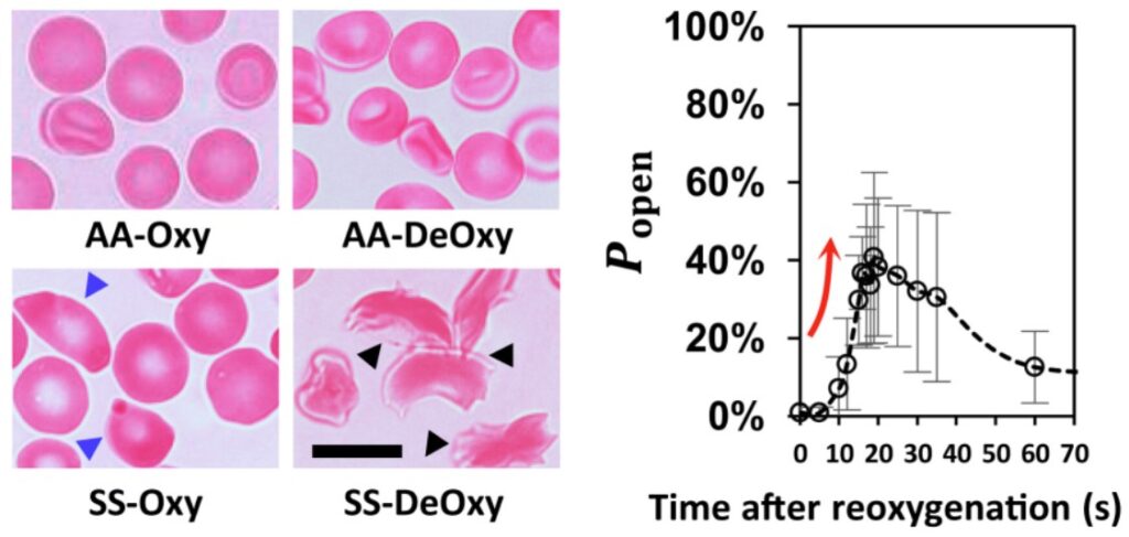 The effects of de- and re-oxygenation on red blood cells from healthy and sickle cell disease patients and the unblocking of the device following reoxygenation.